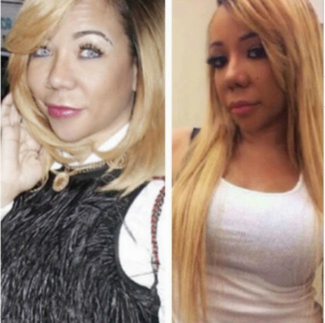 Tameka "Tiny" Harris Plastic Surgery Eyes